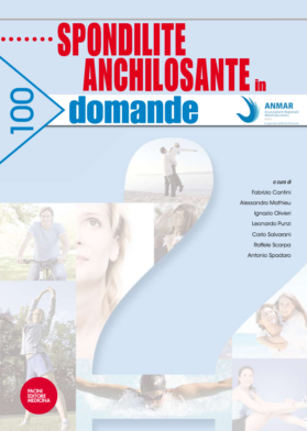 Spondilite anchilosante in 100 domande